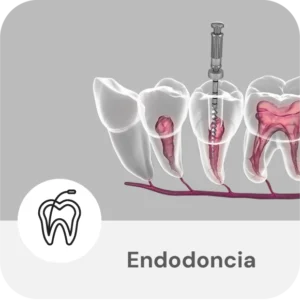 Endodoncia